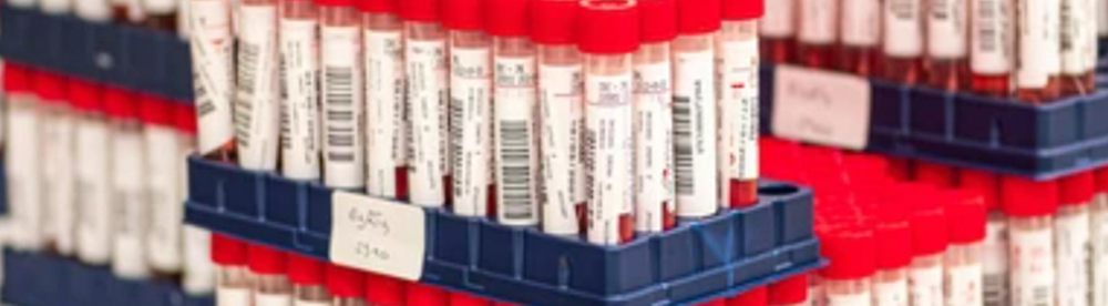 Blood Collection Tubes